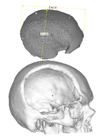 figura3