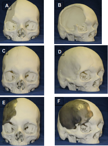 figura4